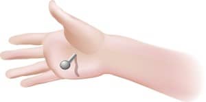 Nail Through Christs Hand